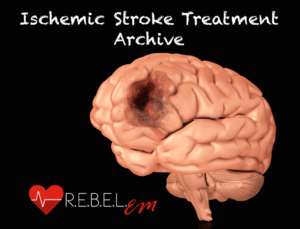Brain model showing ischemic stroke lesion