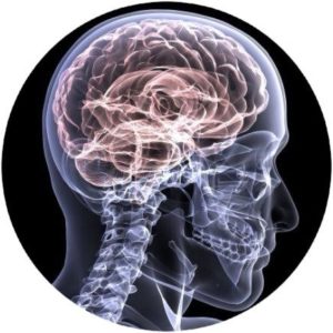 Parkinson's Disease Scottsdale Functional Neurology