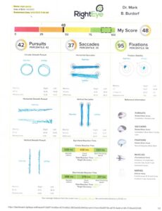 RightEye eye-tracking assessment report page