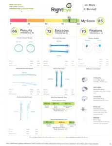 RightEye vision assessment results with scores