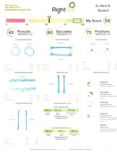 RightEye eye-tracking report showing numeric scores