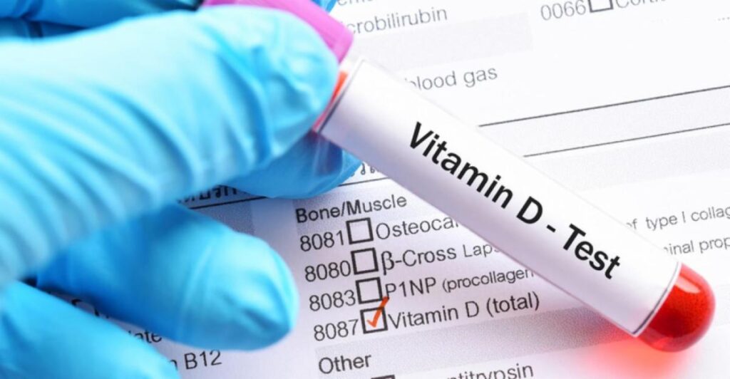 Buy vitamin D test